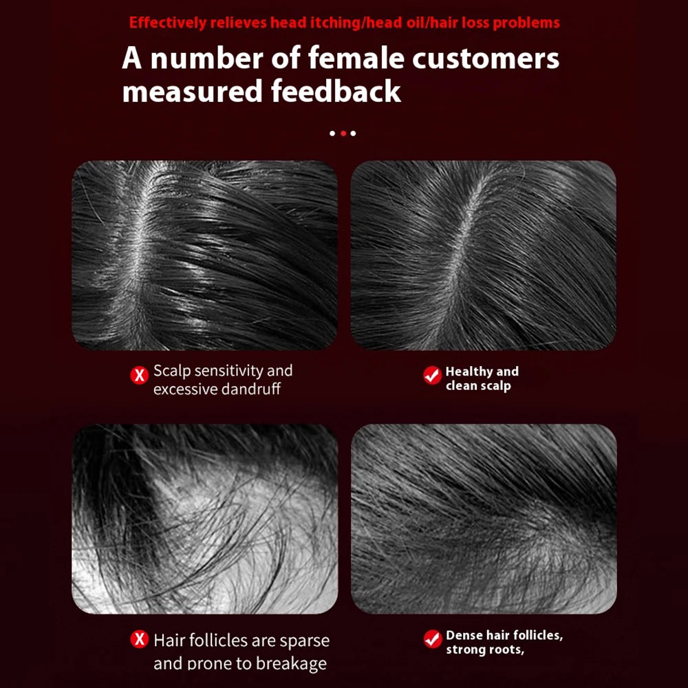 Electric Hair Scalp Massager Brush with Red Light Devices Hair Growth Oil Applicator & Massage Comb Targeted Head Massager